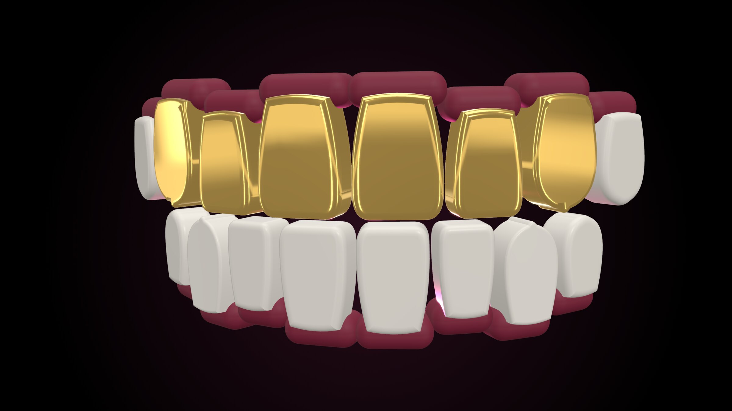 3D render of an 18ct gold top-six grill on a model smile